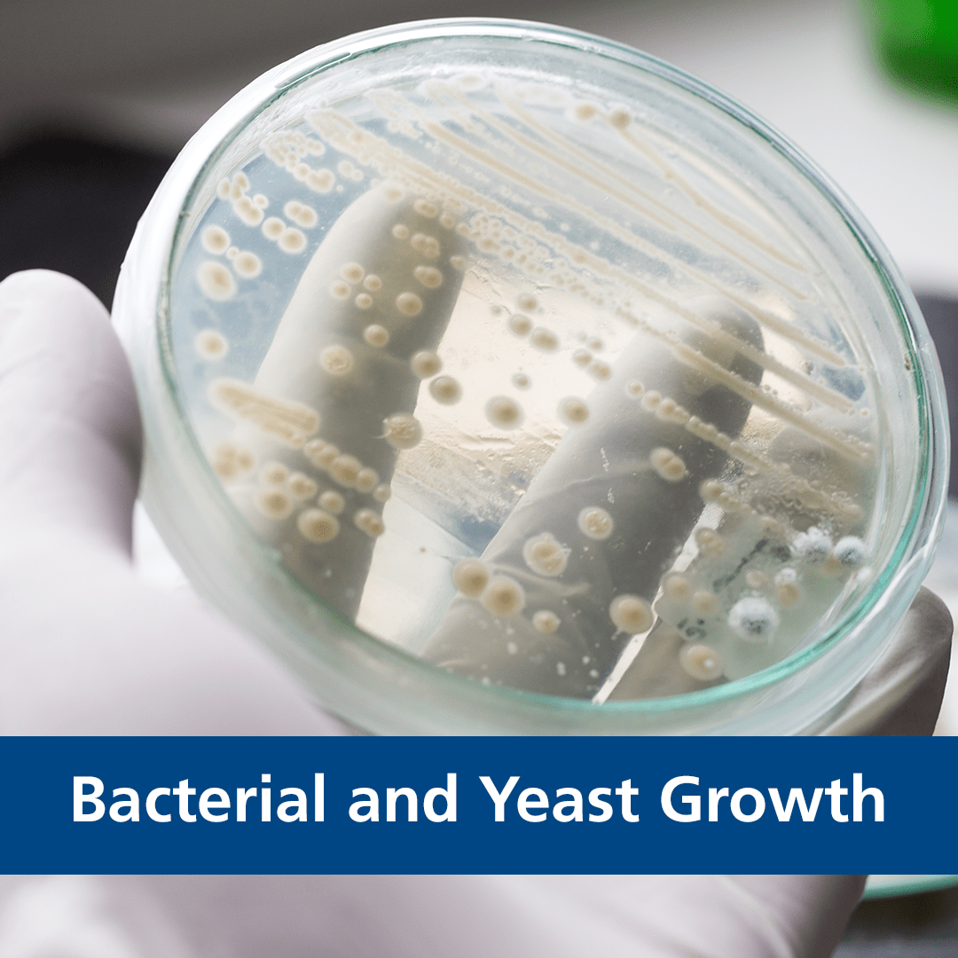 Bacterial and Yeast Growth Bacterial and Yeast Growth